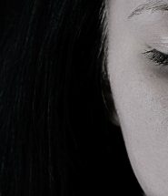skin pigmentation